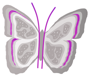 Systemic lupus erythematosus, including lupus nephritis
