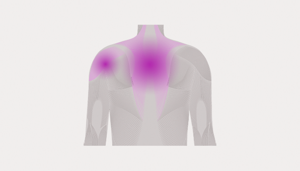 Idiopathic inflammatory myopathies / Myositis